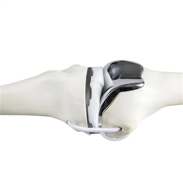 TiAl_metal_injection_molding_MIM_parts_1716619460548_2.jpg_w720